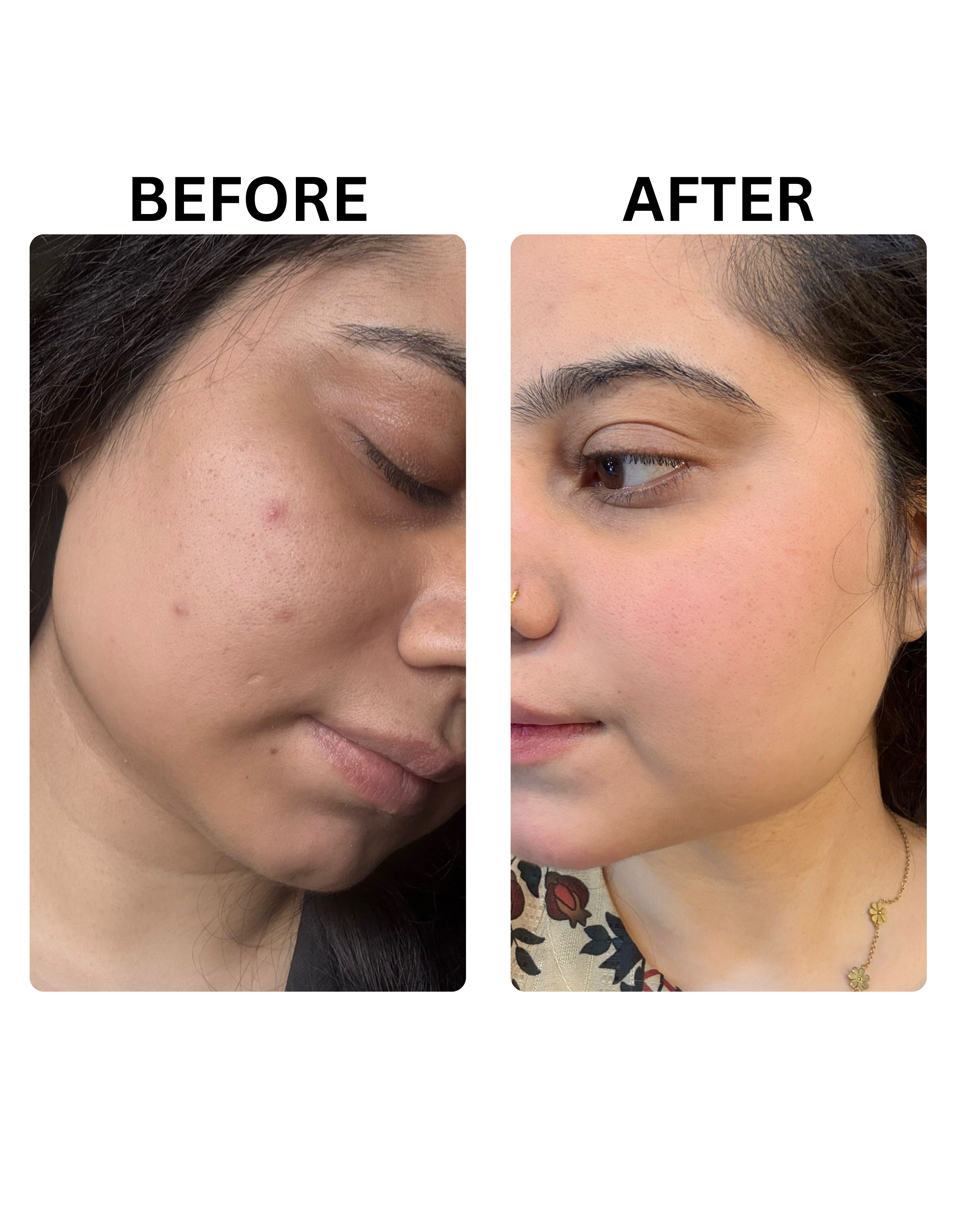 Zenova Brightening Duo Pack
